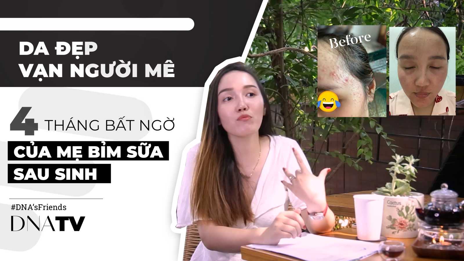 4 tháng cùng DNA giúp Ms Quỳnh- Bà mẹ bỉm sửa tự tin hơn với làn da đẹp không mụn nám