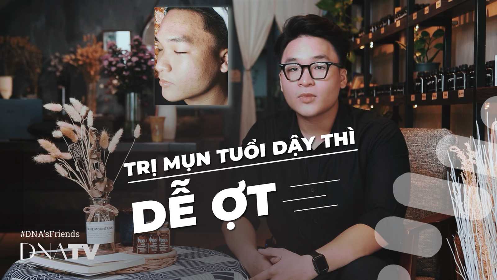 Điều trị mụn tuổi dậy thì |Long Hòa đã đạt được kết quả sau 4 tháng tại DNA