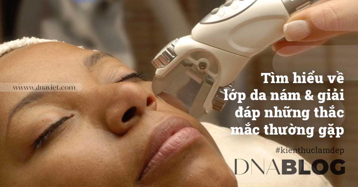 Tìm hiểu về lớp da nám và giải đáp những thắc mắc thường gặp